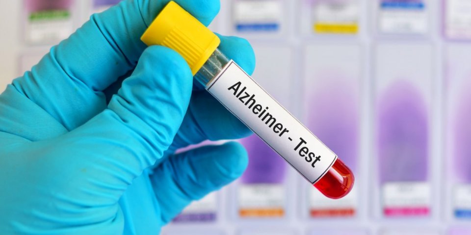 Alzheimer : ce test peut détecter la maladie 17 ans plus tôt