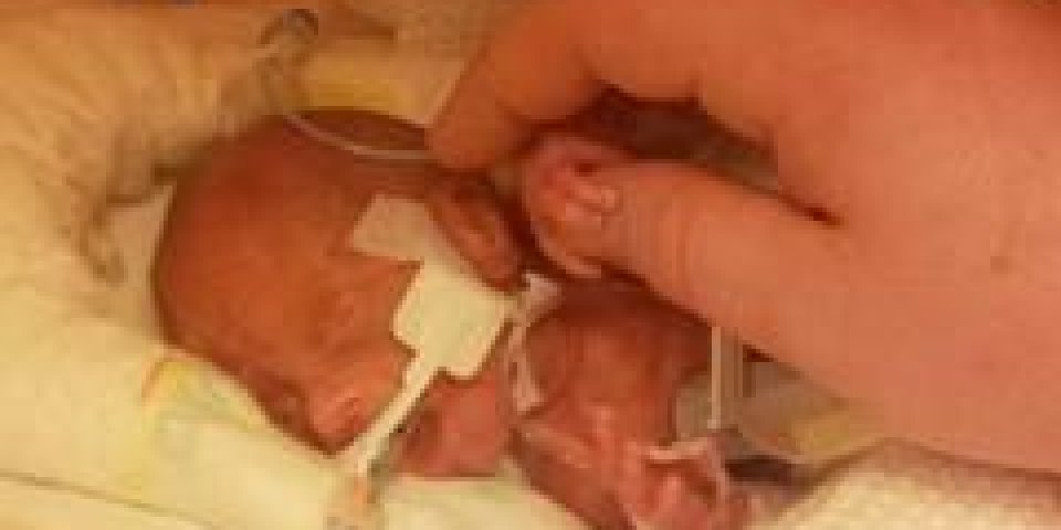 Un bébé né à 23 semaines a survécu !