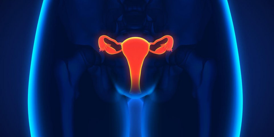 Cancer de l'ovaire : les différents stades