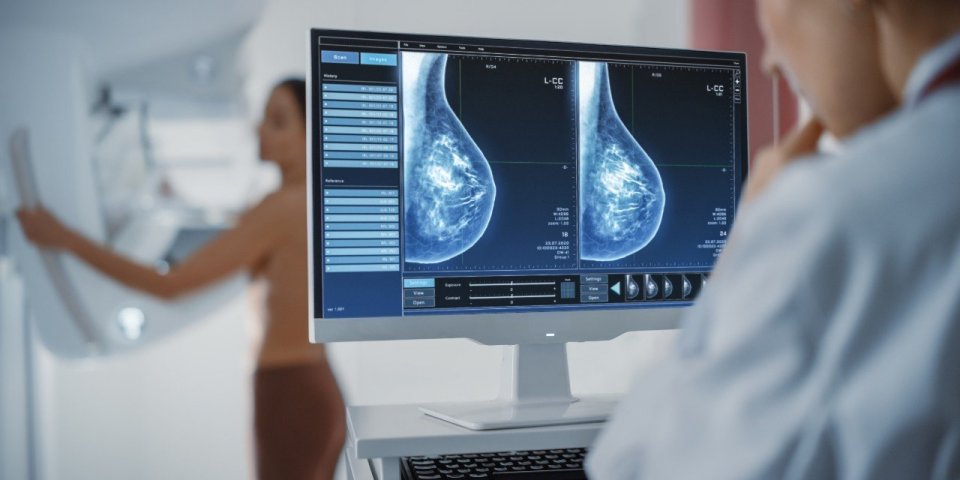 La mammographie pourrait prédire vos risques de maladie cardiovasculaire