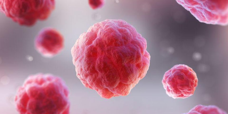 Cancer du sein : le gène à l'origine de la propagation des métastases découvert ? 
