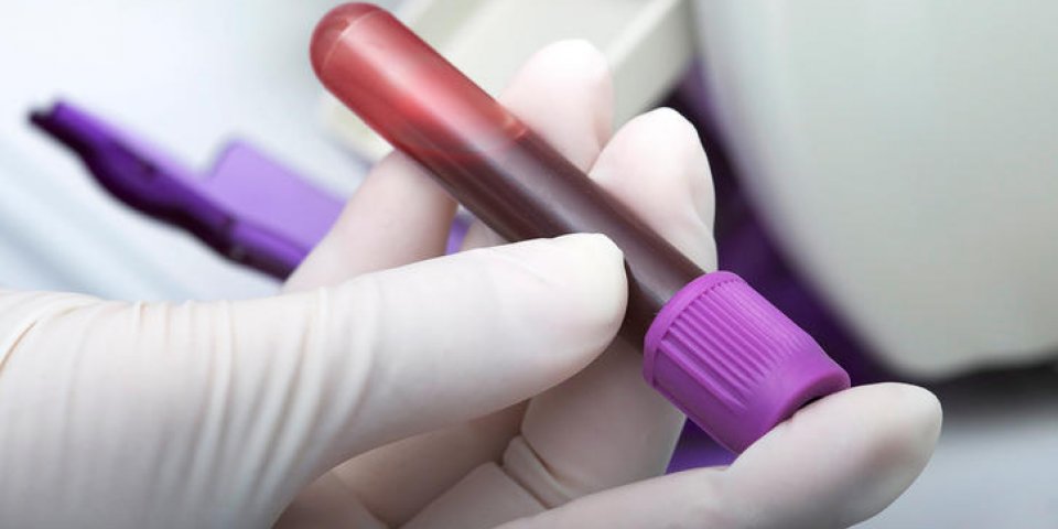 Ce test sanguin prédit si vous allez avoir une attaque cardiaque dans les 30 jours