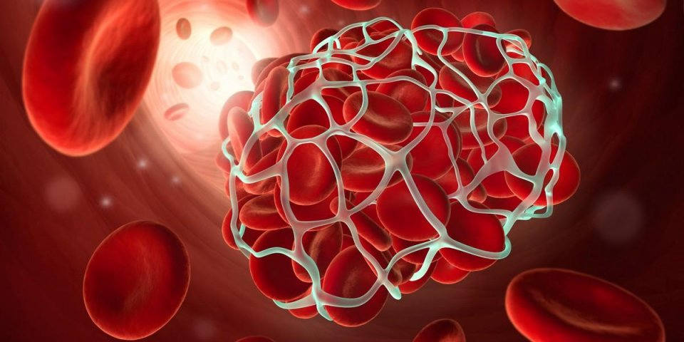 Caillot sanguin : 3 zones du corps qui peuvent montrer que le sang coagule 