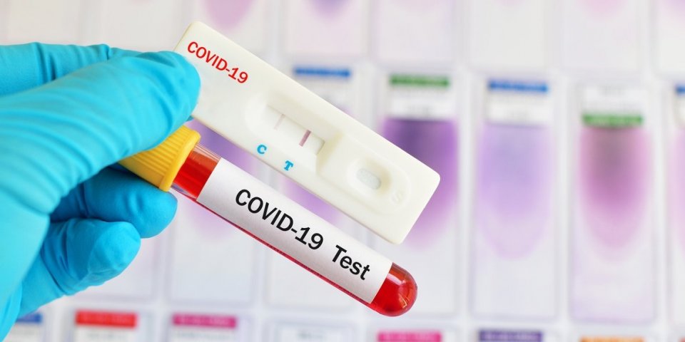 Coronavirus : les tests de dépistage disponibles sont-ils fiables ? 