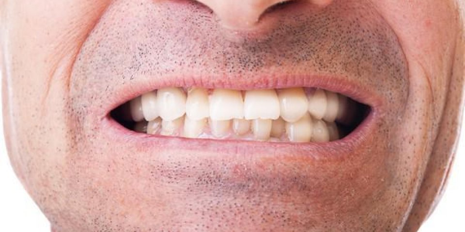Ce problème dentaire peut révéler des troubles de l’érection