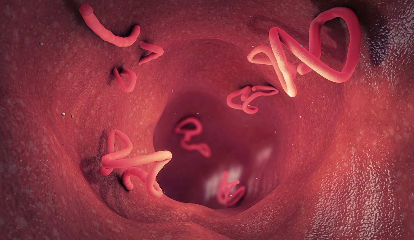 Ces symptômes qui montrent que vous avez des vers intestinaux