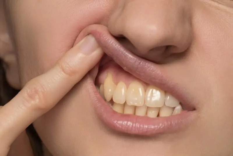 yellow is not even and crooked lower teeth of a young woman