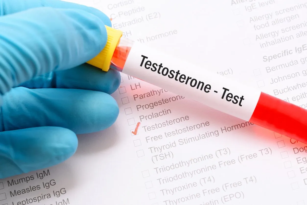 blood sample for testosterone hormone test