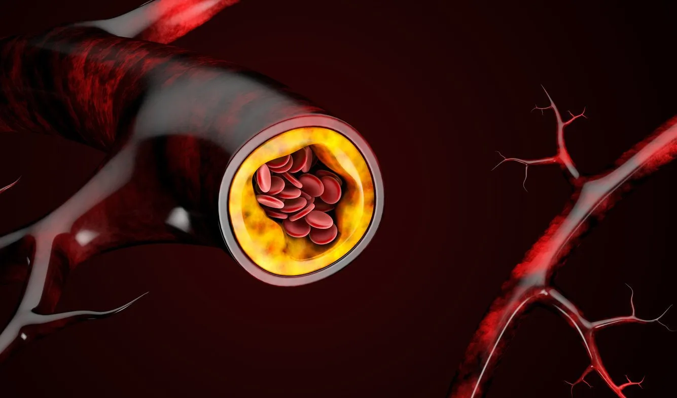 3d illustration of blood cells with plaque buildup of cholesterol