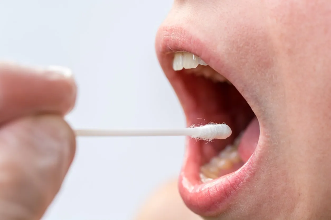 saliva test on the mouth with cotton swabs as a test for various diseases