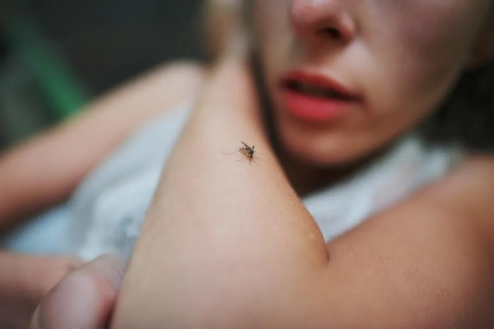 a mosquito sits on the woman's hand and sucks blood pain, itching, danger of infection