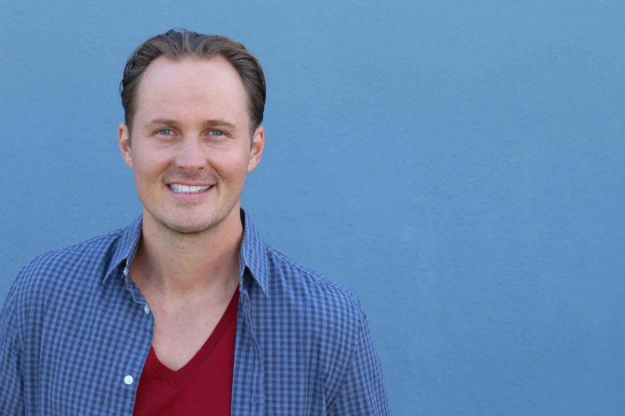 gros plan d'un jeune homme avec un sérieux problème de perte de cheveux pour le concept de perte de cheveux