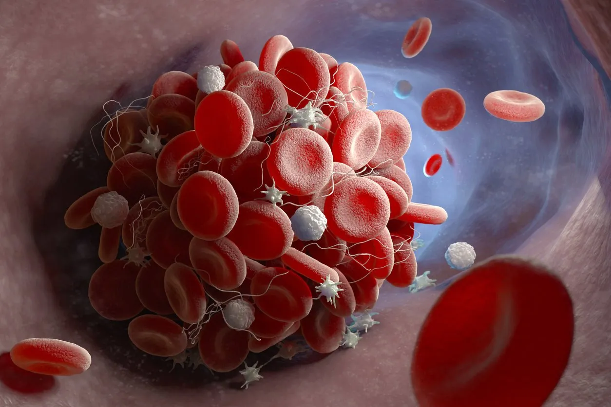 depiction of a blood clot forming inside a blood vessel 3d illustration