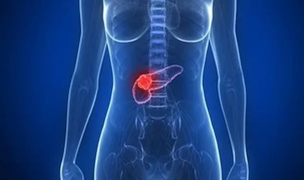cancer du pancréas marqué