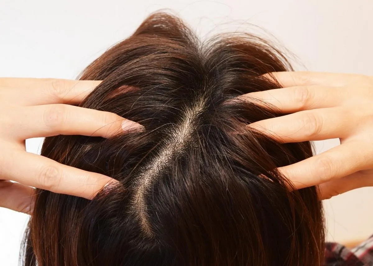 頭皮をマッサージする30代の女性