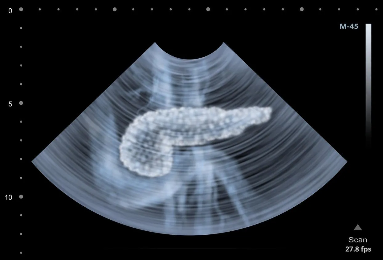 ultrasound scan of human pancreas illustration