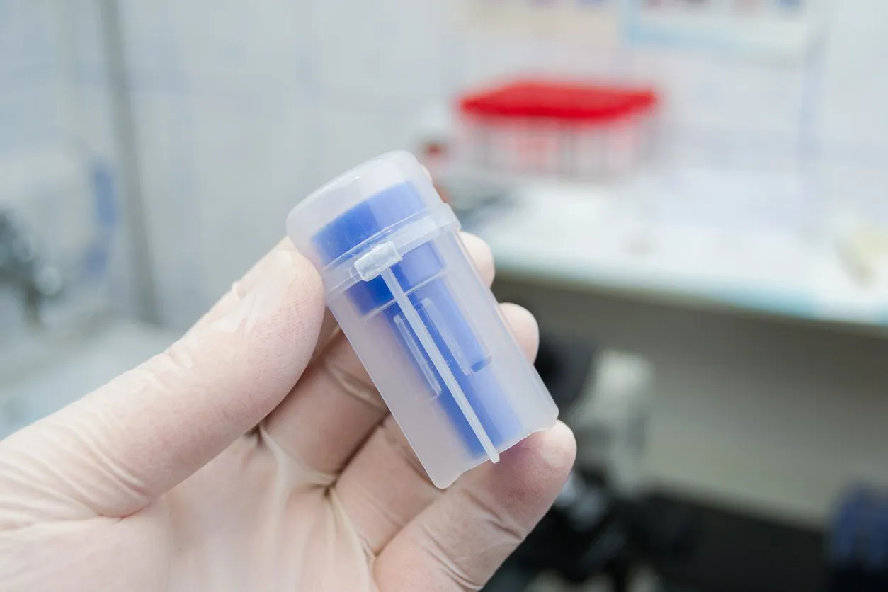 laboratory worker holding in his hand a bottle for feces samples