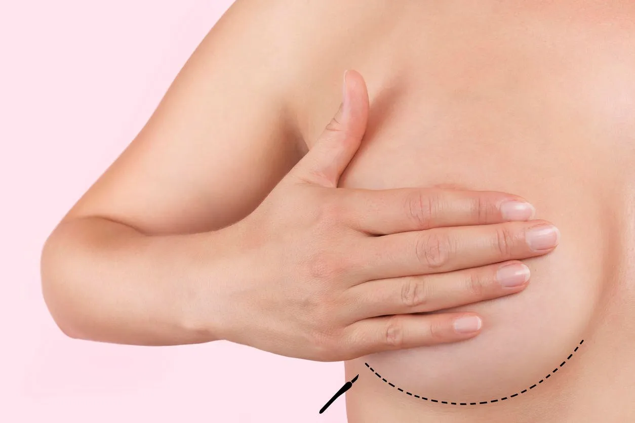 aesthetic medicine and plastic surgery female hand covering breast with dotted outline isolated on pink background beauty and perfection