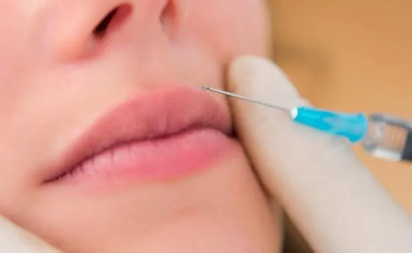 vue rapprochée détaillée d'une injection de lèvre
