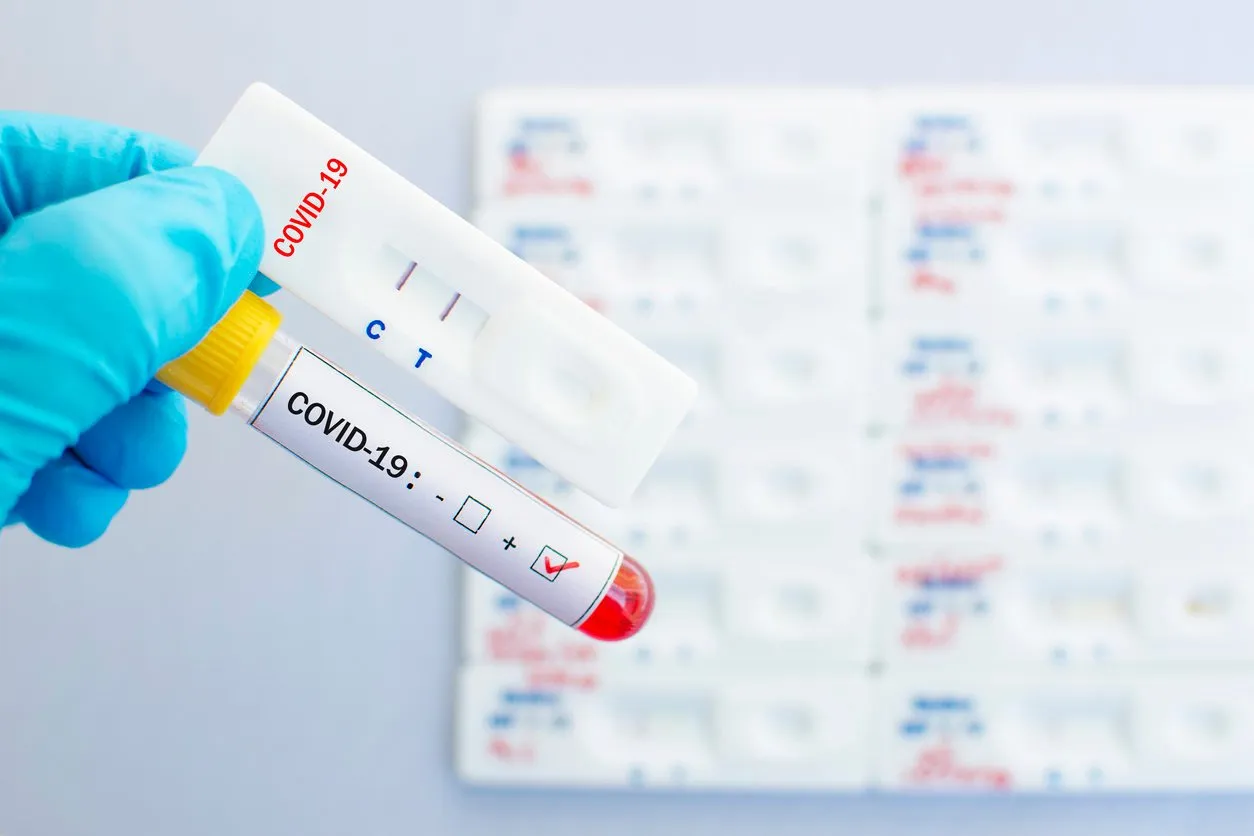 cassette rapid test for covid-19 or novel coronavirus 2019 found in wuhan, china