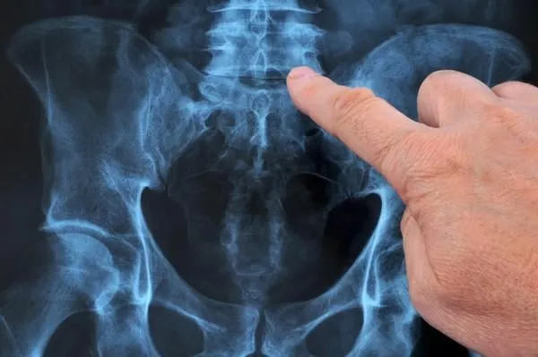 radiographie du rachis dorso-lombaire