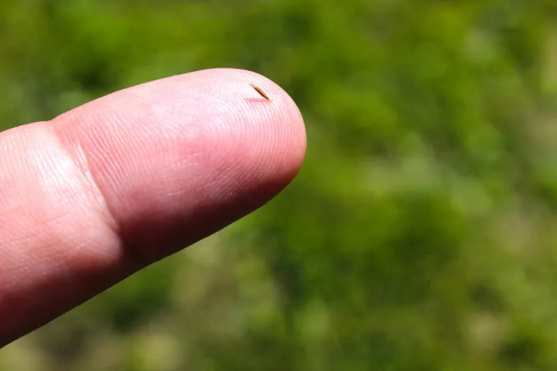 a splinter in the finger close-up