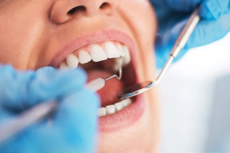 open female mouth during oral checkup at the dentist selective focus