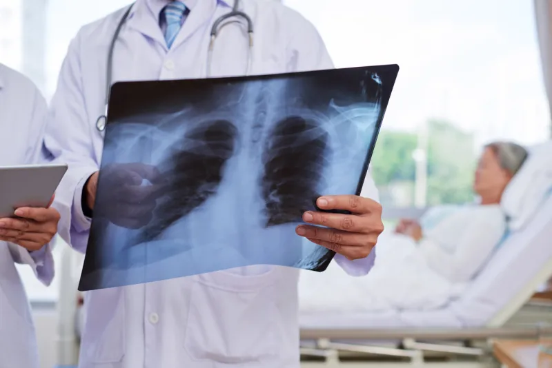 chest x-ray in hands of medical worker