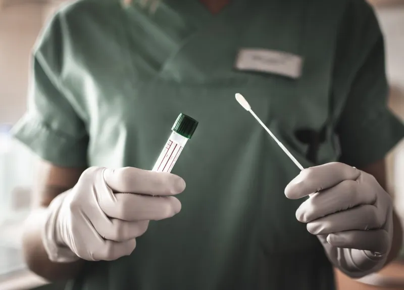nurse holds a swab for the coronavirus   covid19 test