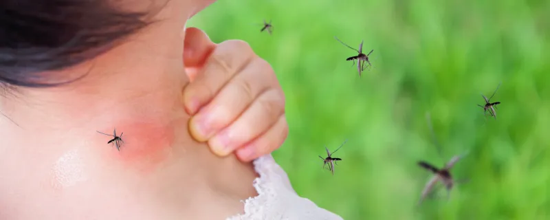 cute asian baby girl has rash and allergy on neck skin from mosquito bite and sucking blood while playing outdoor