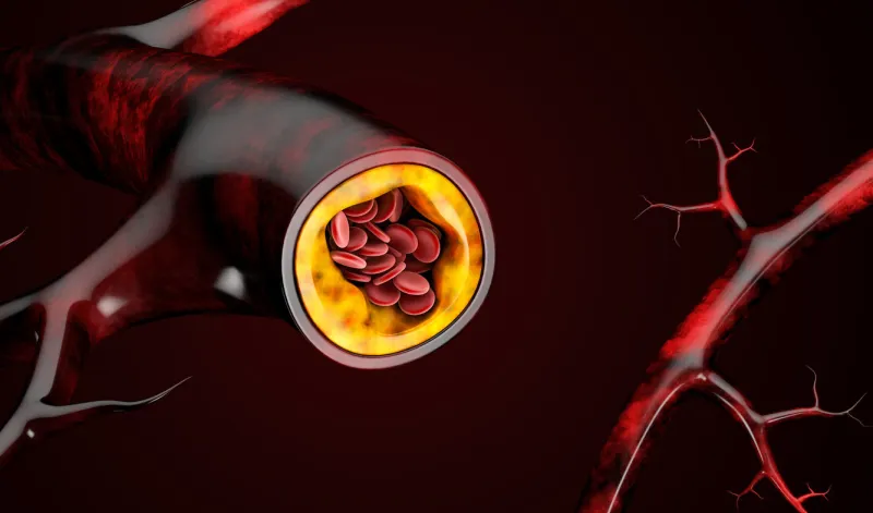 3d illustration of blood cells with plaque buildup of cholesterol