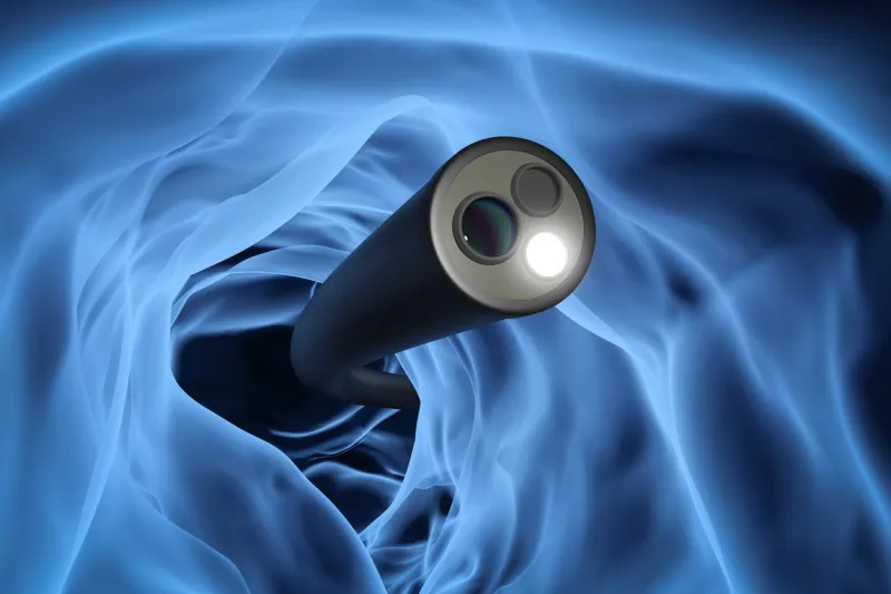 colonoscopy technology concept with 3d rendering x-ray endoscope inside of intestine