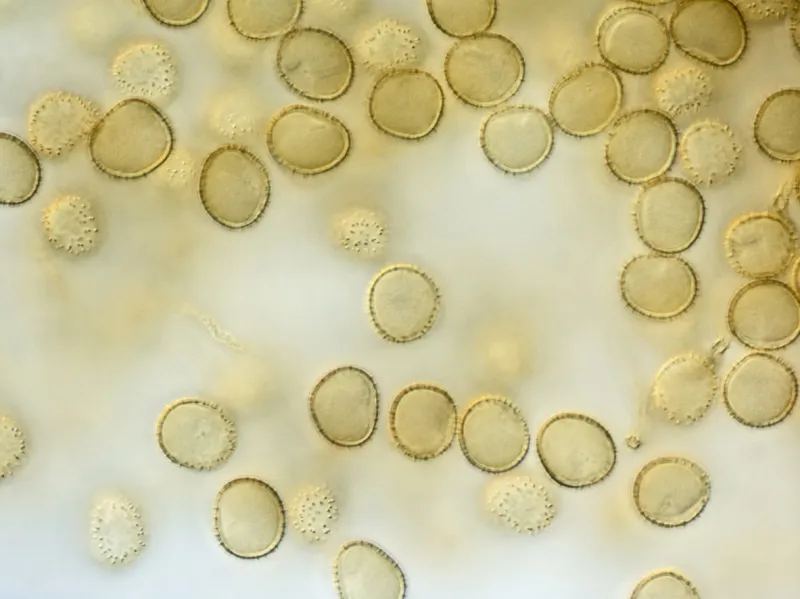 spores of a slime mold, or myxomycete yellow color high score microscopy slime moulds are special organisms that gather from many microscopic unicellular amoebae