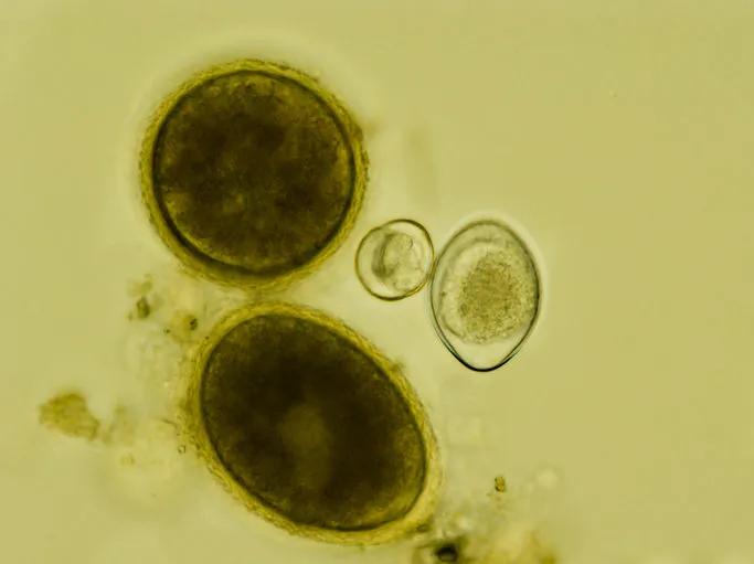 two eggs of toxocara cati and two oocysts of isospora felis under the microscope