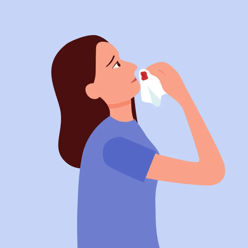 young woman with a nosebleed in flat design on white background