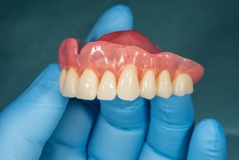 close-up human denture of the upper jaw on a blue background in the hand of dentist wearing a medical glove