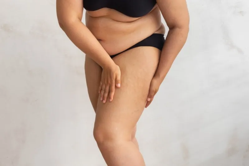 unrecognizable overweight woman with sag hips, obesity, excess fat in lingerie on white isolated background squeezing cellulite thigh gaining weight after childbirth flabs, overeating problems