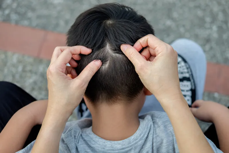 mother is catching hair to find lice and treatment hair in children