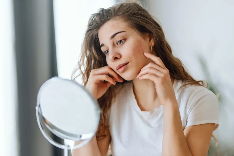 young woman with problem skin looking into mirror