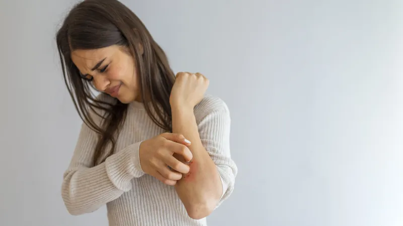 young woman scratching arm from having itching on white background cause of itchy skin include insect bites, dermatitis, food drugs allergies or dry skin health care concept close up