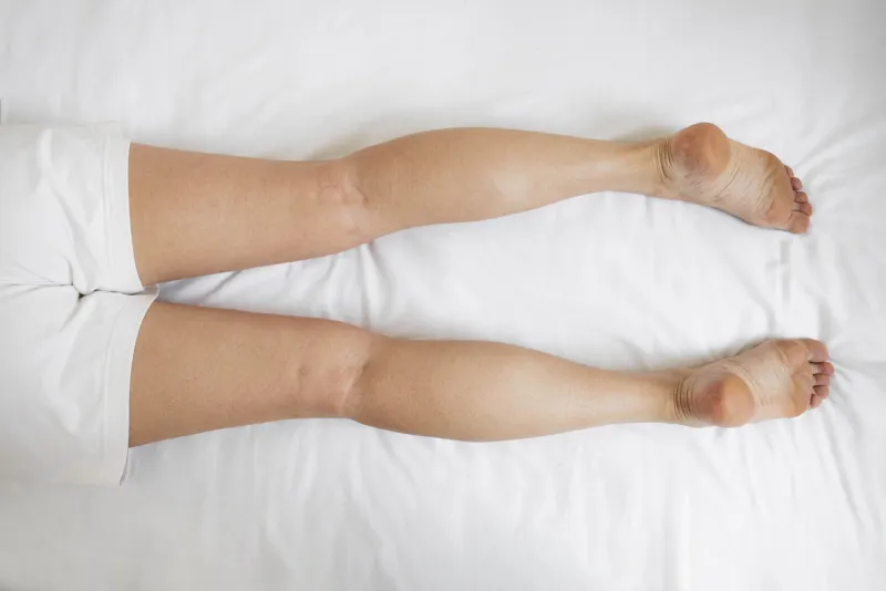 système lymphatique