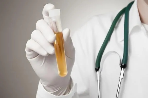 médecin tenant une bouteille d'échantillon d'urine