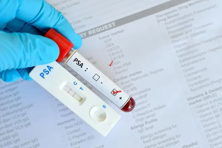psa test en utilisant une cassette de test, le résultat a montré positif (double ligne rouge)