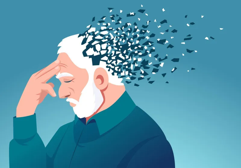 memory loss due to dementia vector of a senior man losing parts of head as symbol of decreased brain function