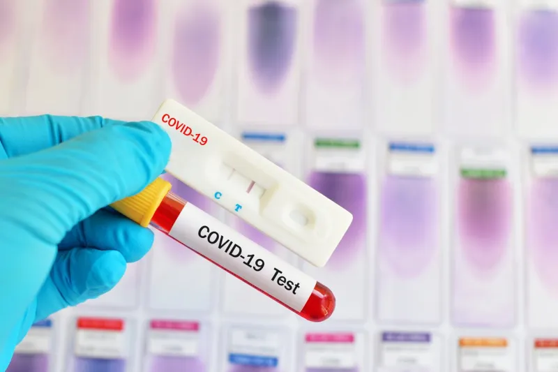 cassette rapid test for covid-19 or novel coronavirus 2019 found in wuhan, china