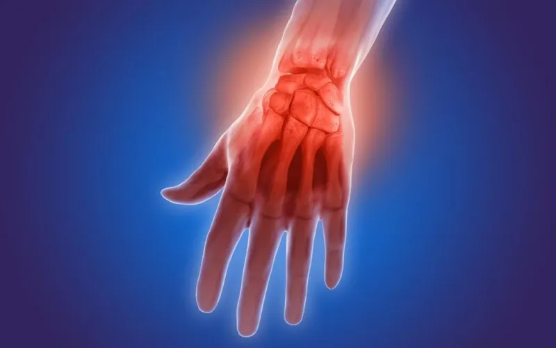 illustration 3d qui montre la douleur de l'arthrite dans le poignet et les doigts du poignet