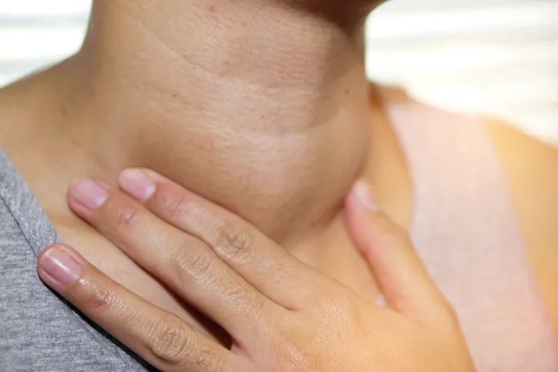 asian lady woman patient have abnormal enlargement of thyroid gl