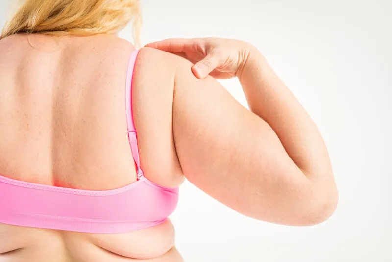 overweight woman with fat hands and back, obesity female body on gray background, studio shot