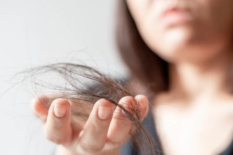 hand of female holding hair fall or loss is a problem of women on white background