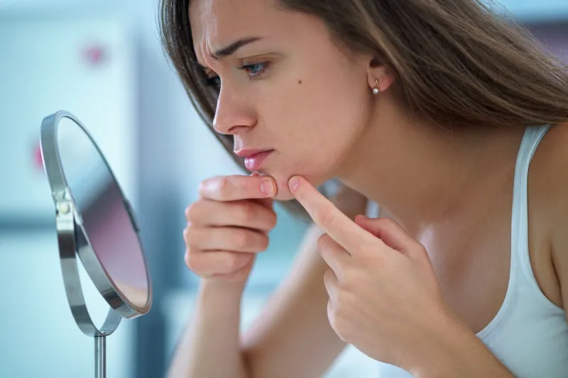 upset stressed sad acne woman with problem skin squeezes pimple at home in front of a small round mirror